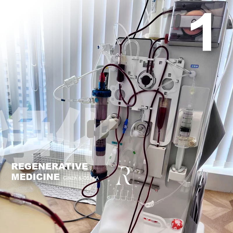 血液净化疗法/旭化成加温式DFPP双重血浆交换疗法（适用人群高血脂）单次