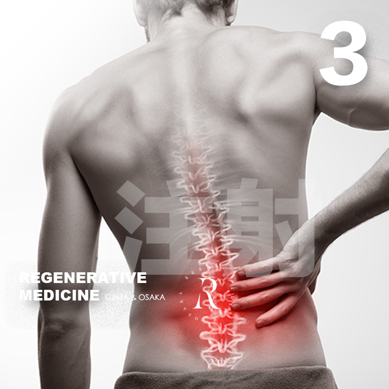 自体脂肪来源的间充质干细胞点滴/局部治疗关节、面部·颈部、头皮、脊椎（细胞数量0.5亿/次）3次